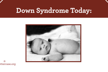 Presentation slide with title "Down Syndrome Today" and a photo of a baby with Down syndrome